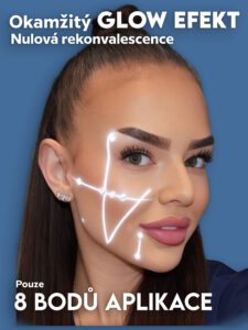 hydratovaná zářivá pleť po BabyGlow ošetření – FaceExpert